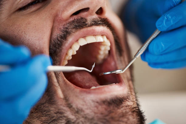 Best Weekend Emergency Dentist in Centerville, IA